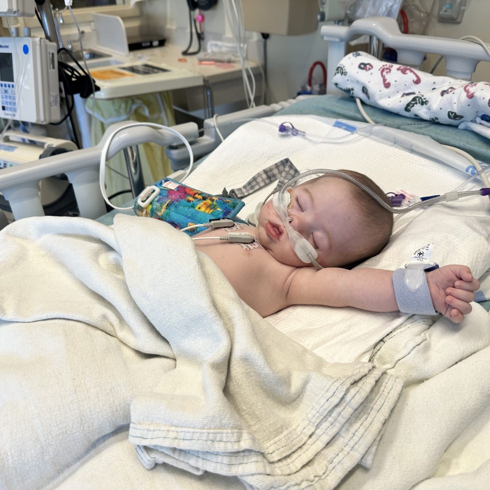Baby in the intensive care nursery connected to tubes and wires
